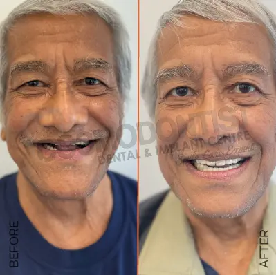 Before and after dental treatment result 10 at Cosmodontist Clinic