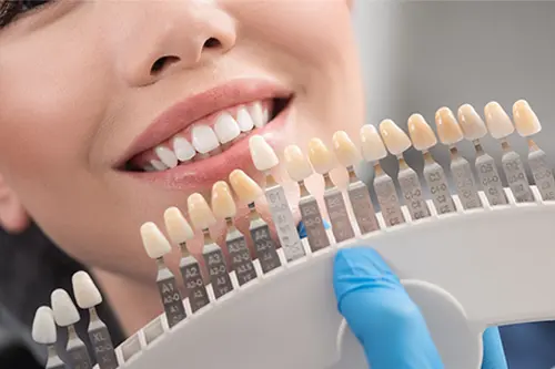 All-ceramic or all-porcelain Crowns