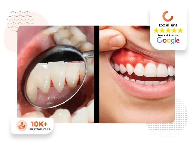 gum treatment about