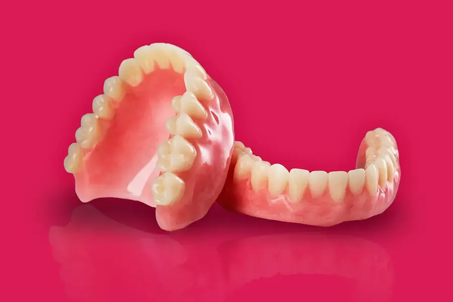 Implant Retained Dentures in Gurgaon