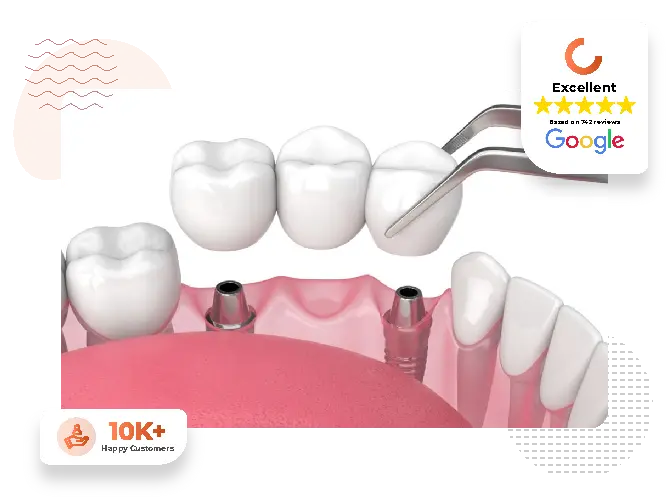 implant supported